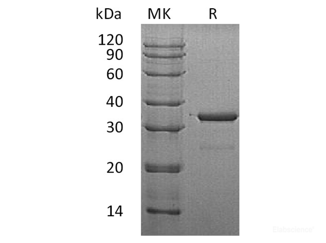Recombinant Human Cytosolic Sulfotransferase Family 1A Member 3 Protein-Elabscience