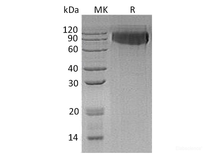 Recombinant Human Glycoprotein Non-Metastatic Melanoma Protein B Protein-Elabscience