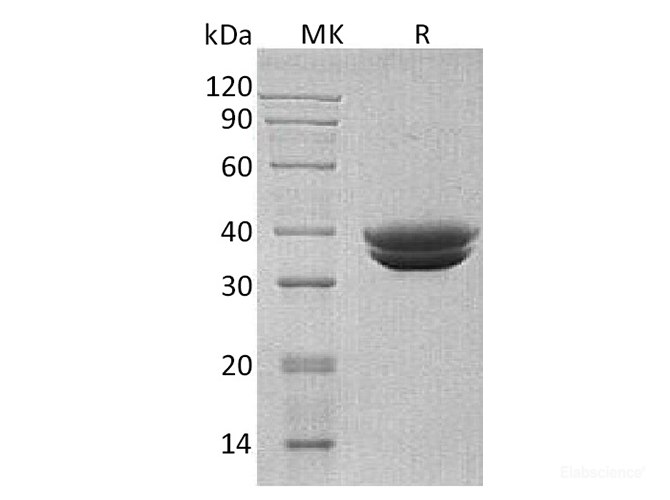 Recombinant Human Glycoprotein A33 Protein-Elabscience