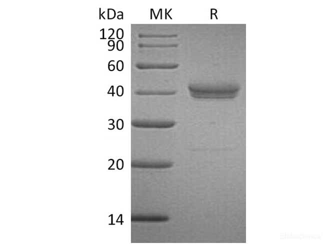 Recombinant Human Cell Adhesion Molecule 3 Protein-Elabscience