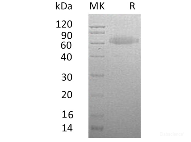 Recombinant Human R-spondin-3 Protein-Elabscience