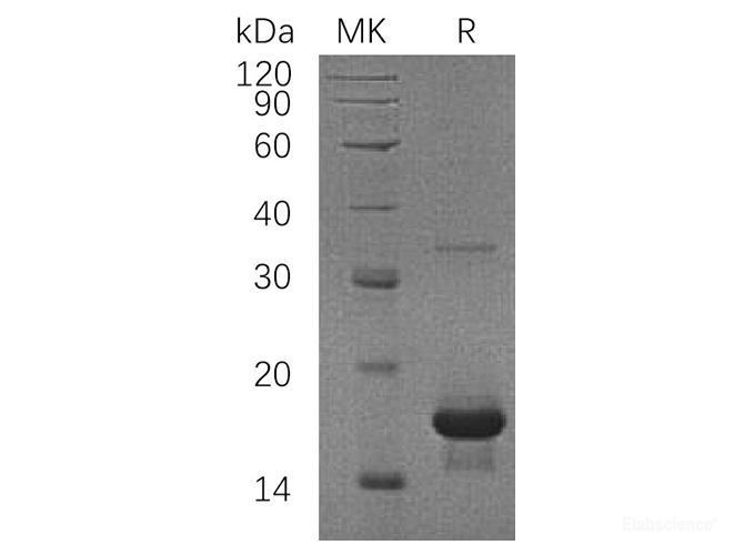Recombinant Human SH2 Domain-Containing Protein 1A Protein-Elabscience