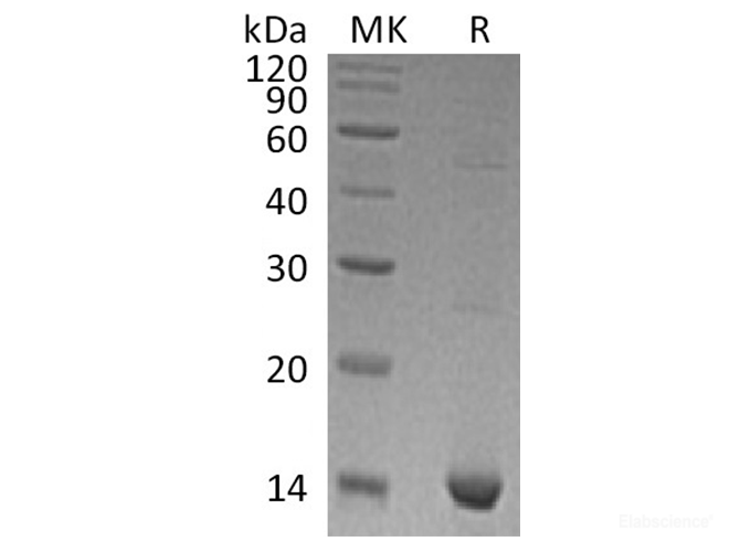 Recombinant Human S100 Calcium Binding Protein A9 Protein-Elabscience