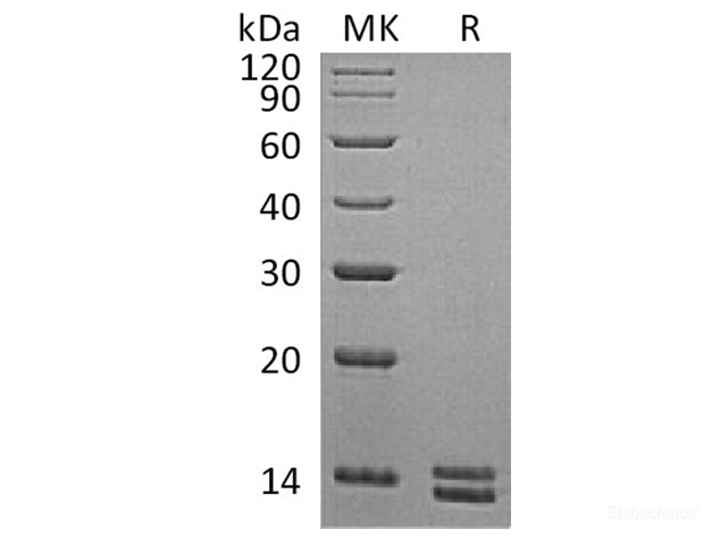 Recombinant Human S100 Calcium Binding Protein S100A8/S100A9 Heterodimer Protein-Elabscience
