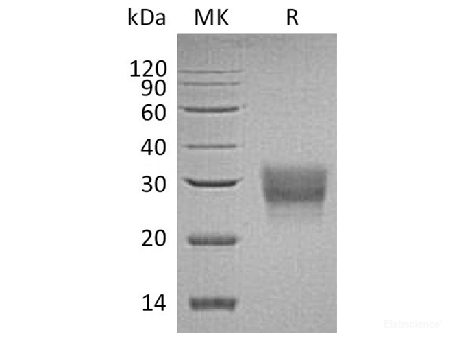 Recombinant Human T-Cell Surface Glycoprotein CD8 beta Chain Protein-Elabscience
