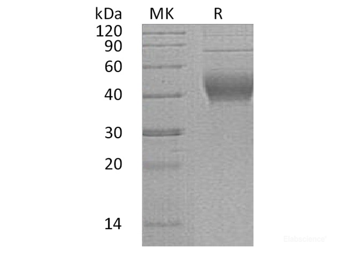 Recombinant Human Interleukin-22 receptor subunit alpha-2/Interleukin-22 Binding Protein Protein-Elabscience