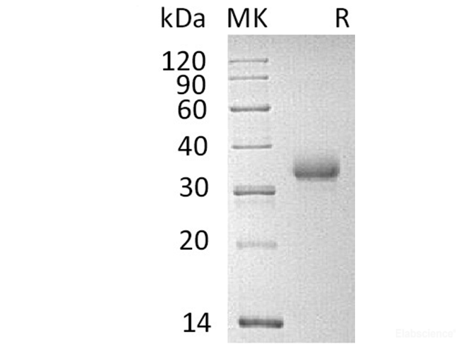 Recombinant Human T-cell surface antigen CD2 Protein-Elabscience