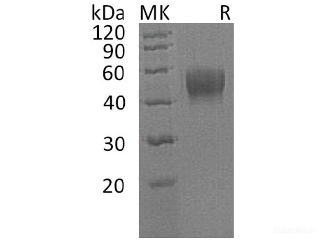 Recombinant Human Interleukin-10 receptor subunit beta Protein-Elabscience
