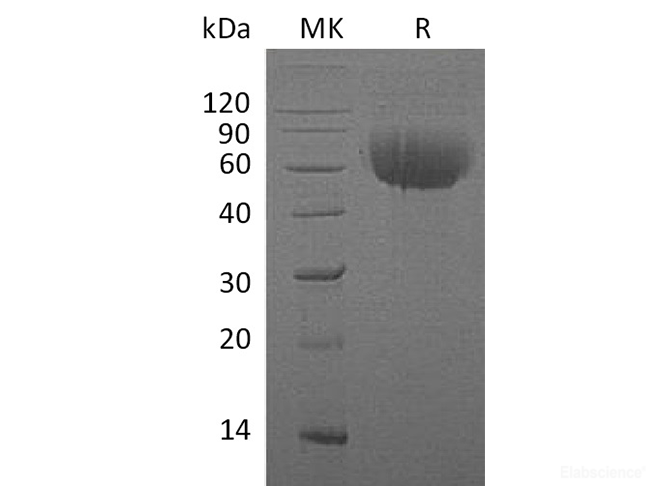 Recombinant Human Interleukin-13 Receptor Subunit Alpha-1 Protein-Elabscience
