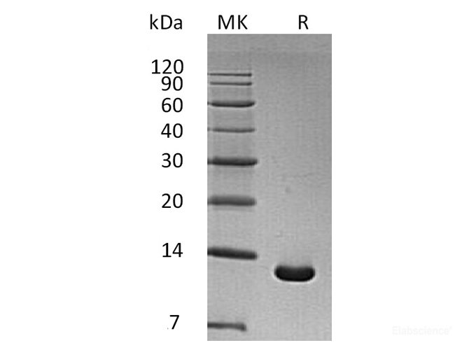 Recombinant Human S100 calcium binding protein A Protein-Elabscience