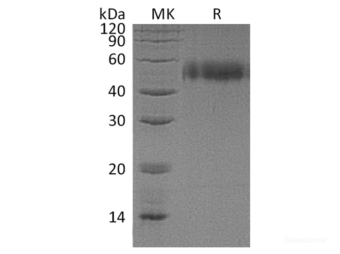 Recombinant Human uPAR / CD87 Protein (C-6His)-Elabscience