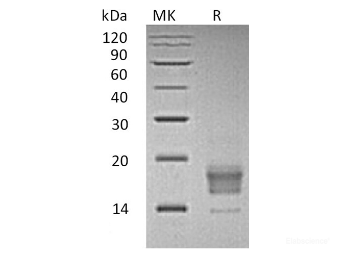 Recombinant Human T cell Immunoreceptor with Ig and ITIM domains Protein-Elabscience