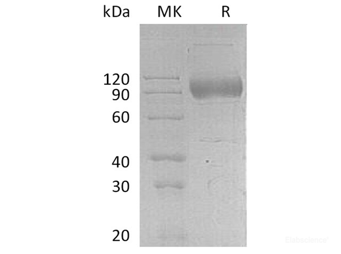 Recombinant Human Interleukin-17 receptor A Protein-Elabscience