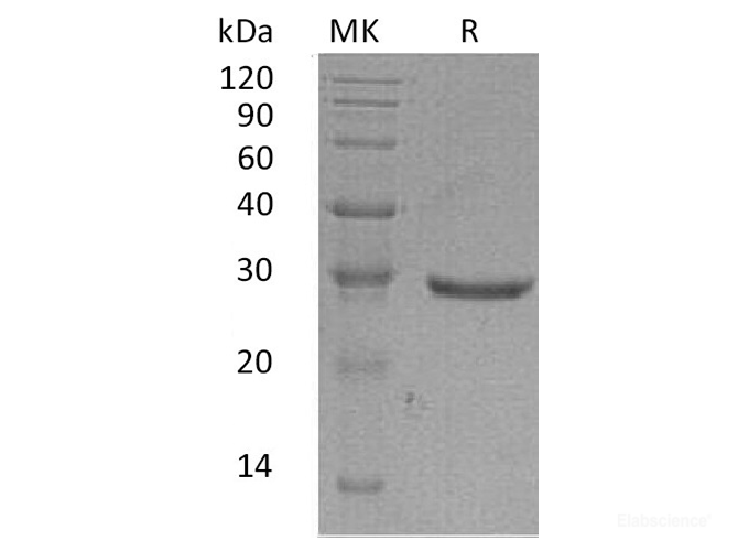 Recombinant Human Glioma Pathogenesis-Related Protein 1 Protein-Elabscience