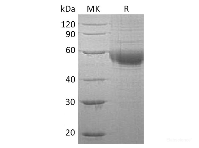 Recombinant Human Platelet-Activating Factor Acetylhydrolase Protein-Elabscience
