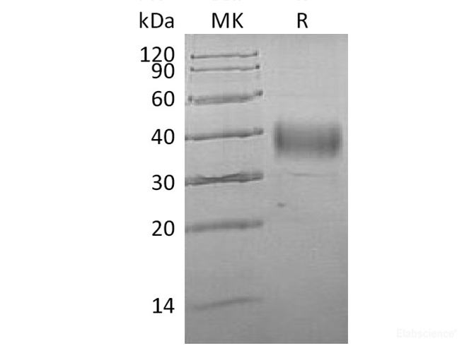 Recombinant Human Asialoglycoprotein Receptor 1 Protein-Elabscience