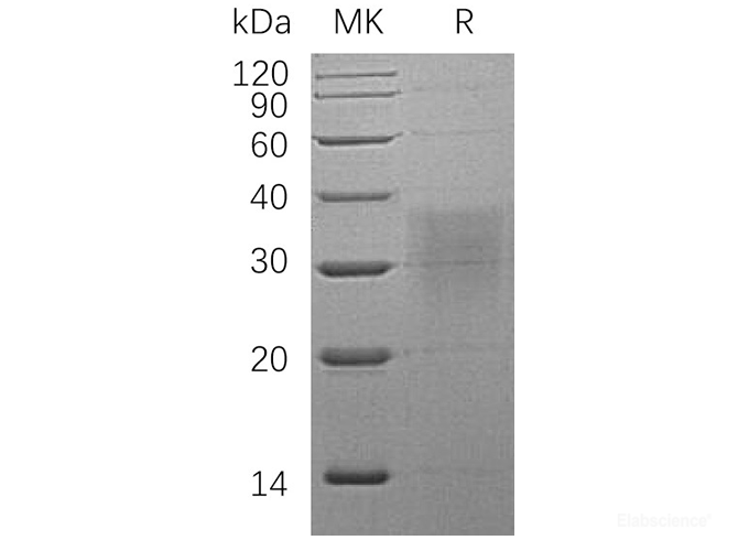 Recombinant Human Bone Morphogenetic Protein Receptor Type IIA Protein-Elabscience