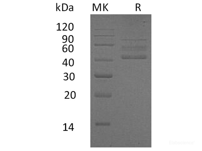 Recombinant Human Receptor Expressed in Lymphoid Tissues Protein-Elabscience