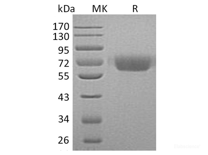 Recombinant Human Kininogen-1 Protein-Elabscience