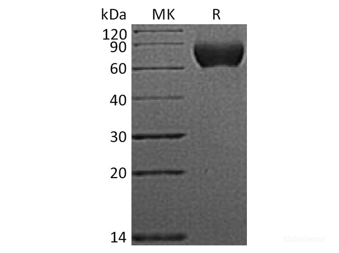 Recombinant Human Nogo-66 Receptor/Reticulon 4 Receptor Protein-Elabscience