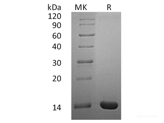 Recombinant Human Interleukin-2/IL-2 Protein-Elabscience