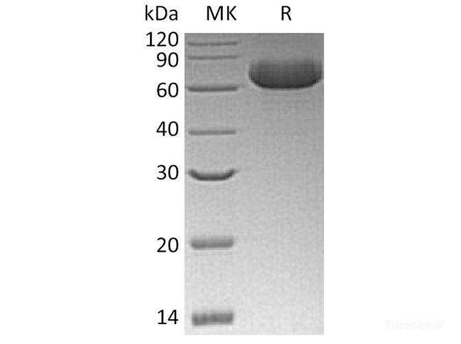 Recombinant Human Glial Cell line-derived Neurotrophic Factor Receptor alpha 2 Protein-Elabscience