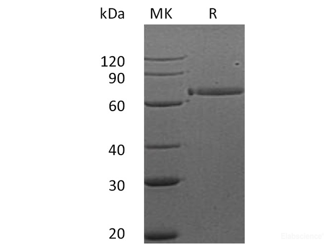 Recombinant Human Receptor tyrosine-protein kinase ErbB-3 Protein-Elabscience