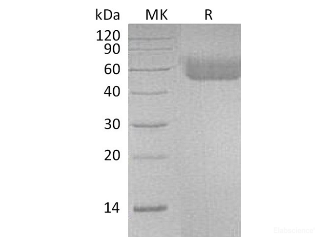 Recombinant Human Interleukin-1 receptor type 1/IL-1R-1 Protein-Elabscience
