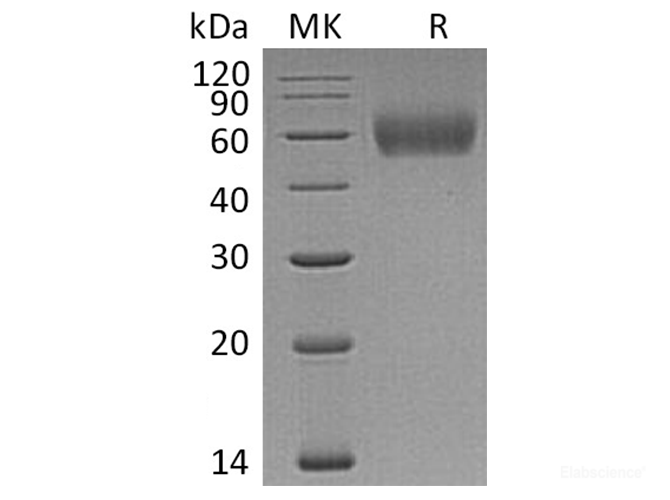 Recombinant Human Interleukin-1 receptor type 2/IL-1R-2  Protein-Elabscience