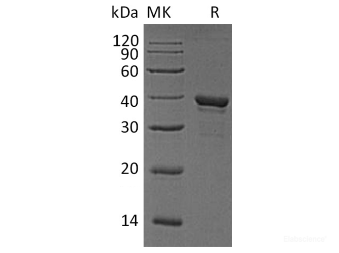 Recombinant Human Arginase-1 Protein (C-His)-Elabscience