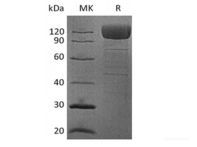 Recombinant Human platelet membrane glycoprotein IV/CD36/SR-B3 Fc Chimera Protein(Fc Tag)