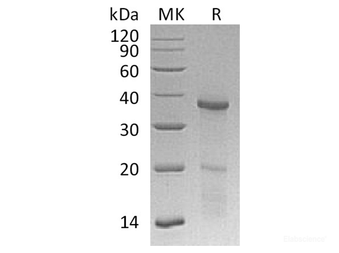 Recombinant Human Homeobox Protein Hox-B4/HOXB4/HOX-2F Protein(N-6His)-Elabscience