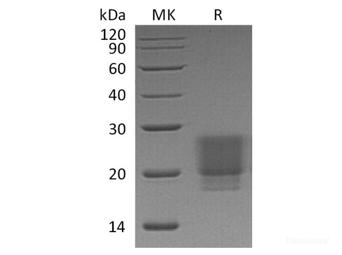 Recombinant Human / Mouse / Rat Irisin / FNDC5 Protein (C-His)-Elabscience