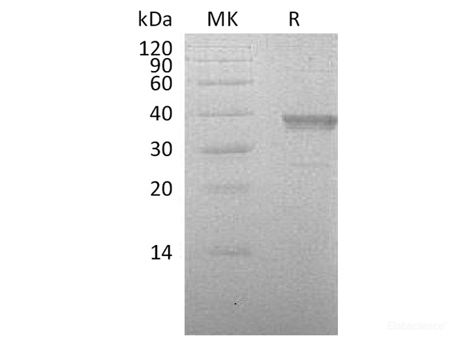 Recombinant Human Hyaluronan-Binding Protein 2/HABP2 Protein(C-6His)-Elabscience
