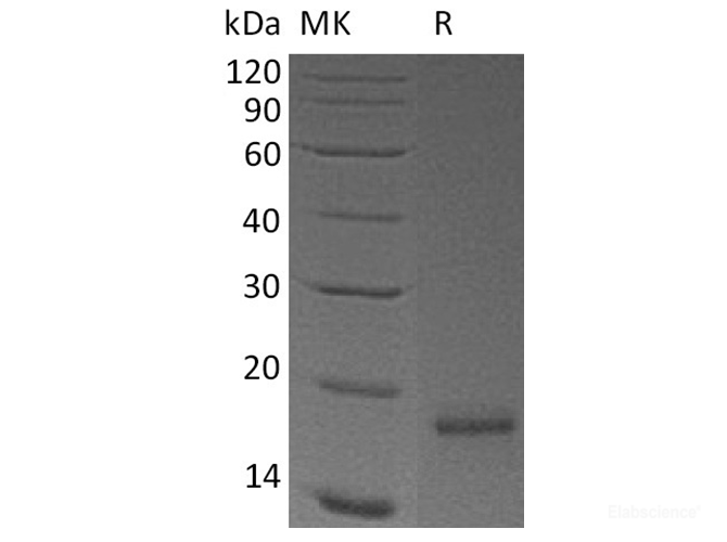 Recombinant Human CLDN18.2 / Claudin-18 A2 Protein (N-His)-Elabscience