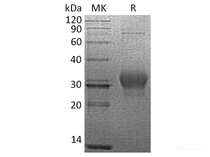 Recombinant Human κ-Casein / CASK Protein (C-His)-Elabscience
