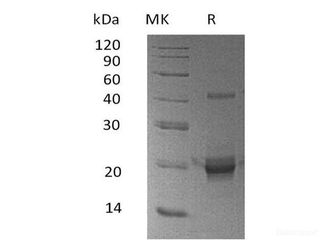 Recombinant Human DUSP3 / VHR Protein (N-His)-Elabscience