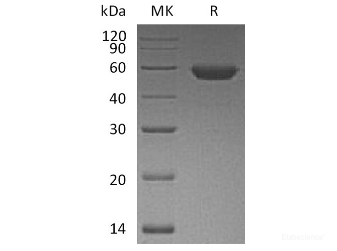 Recombinant Human ROR2 Protein (C-His)-Elabscience
