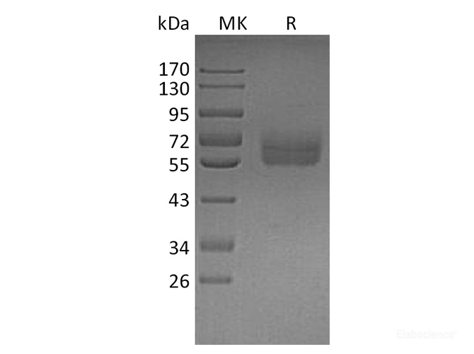 Recombinant Human TYRO3 Protein (C-His)-Elabscience