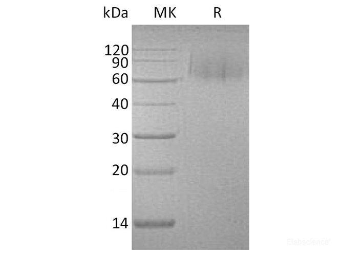 Recombinant Human MERTK / MER Protein (C-His)-Elabscience