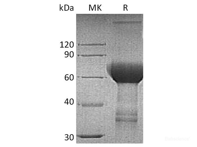 Recombinant Human TROP2 / TACSTD2 Protein (C-Fc)-Elabscience