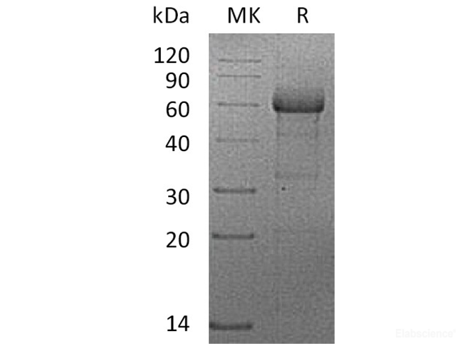 Recombinant Human TNFRSF1B / CD120b / TNFR2 Protein (C-mFc)-Elabscience