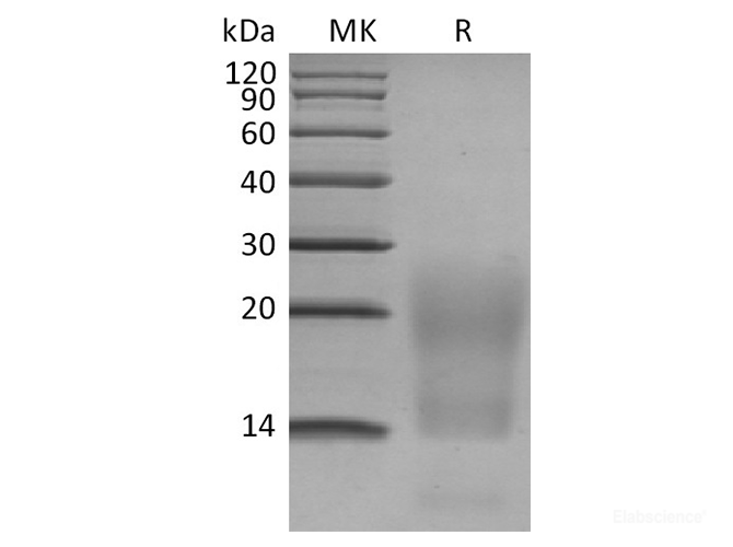 Recombinant Human BCMA / TNFRSF17 / CD269 Protein (C-His)-Elabscience