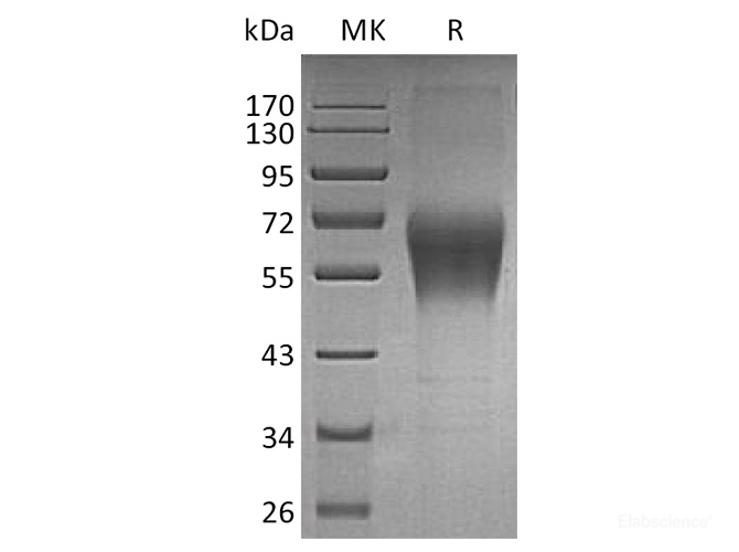Recombinant Human TRAILR4 / TNFRSF10D / CD264 Protein (C-Fc)-Elabscience