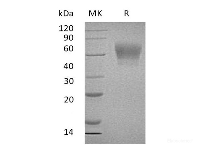 Recombinant Human TPBG / 5T4 / Trophoblast Glycoprotein Protein (C-His)-Elabscience
