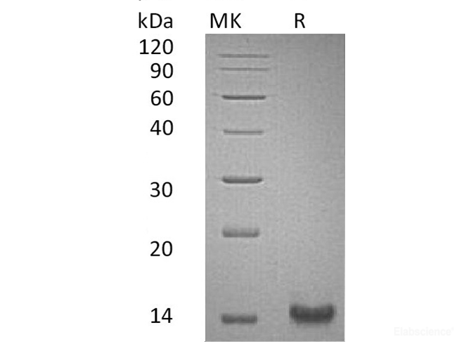 Recombinant Human TFF1 / Trefoil Factor 1 Protein (C-His)-Elabscience