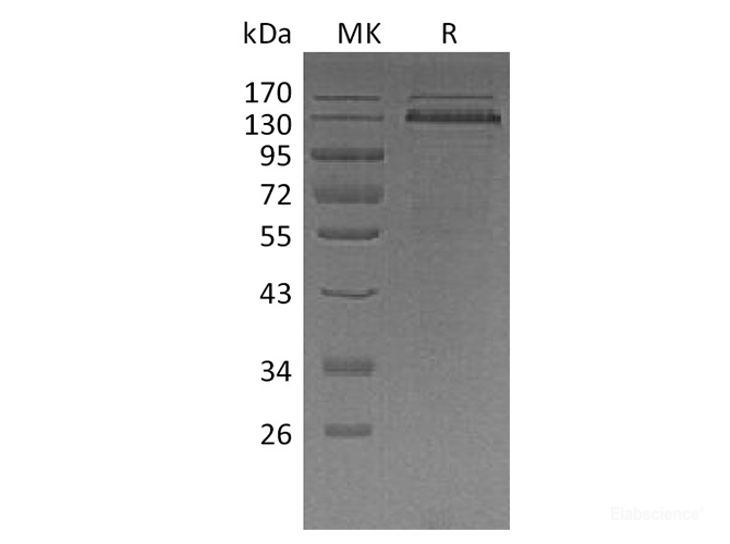 Recombinant Human Thrombospondin-1 / THBS1 / TSP-1 Protein (C-His)-Elabscience