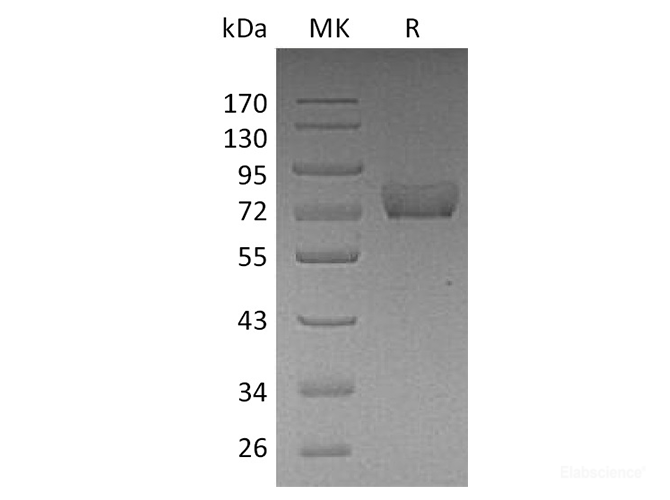 Recombinant Human Thrombomodulin Protein (C-His)-Elabscience