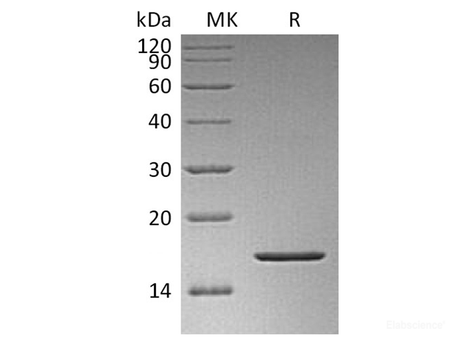 Recombinant Human FGF-2 / FGF basic / FGFb Protein (Met1-Ser155, Lus128Asn) -Elabscience