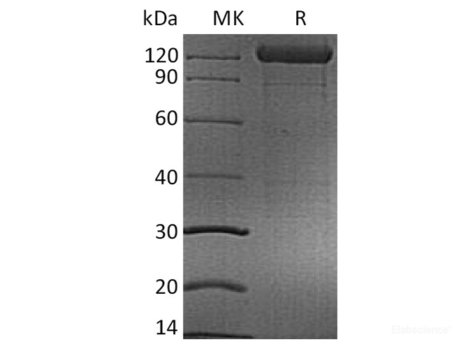 Recombinant Human CD96 / T-cell surface protein Tactile Protein (C-mFc)-Elabscience